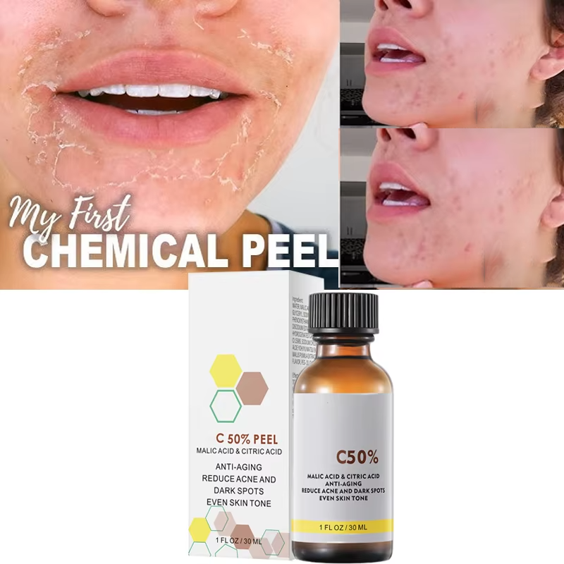 Con ácido málico y ácido cítri - Salicylic Acid Cleanser reseña y precio